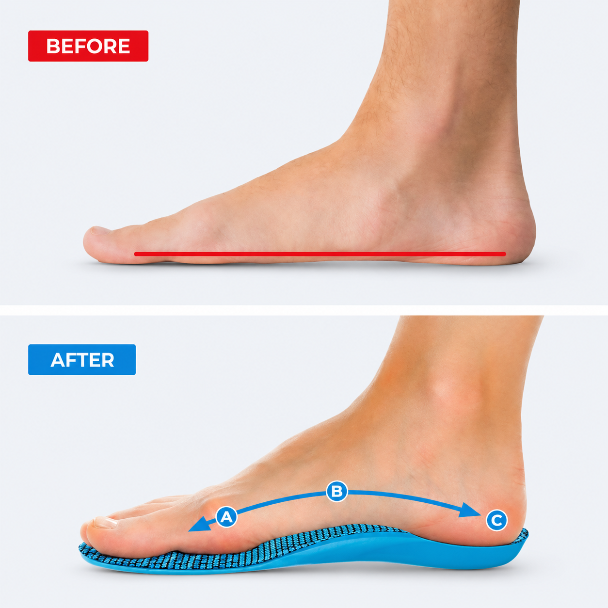 Comfave™ Arch Support Insoles