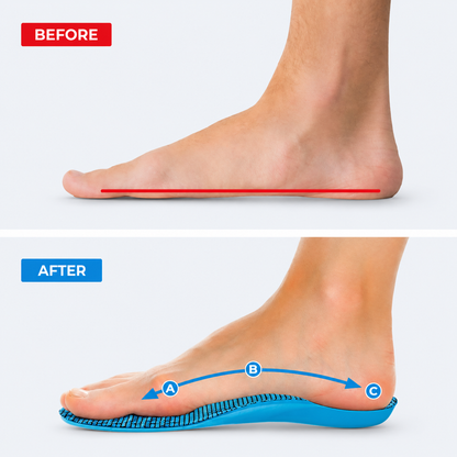 Comfave™ Arch Support Insoles