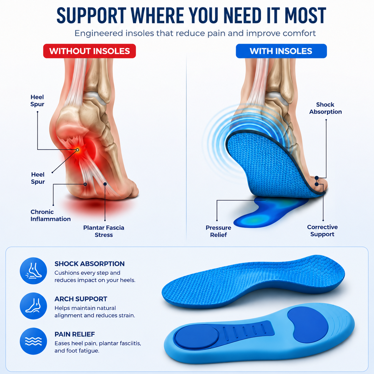 Comfave™ Arch Support Insoles